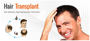Best Hair Transplant In Delhi