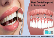 Dental Implants Treatment At Affordable Cost in Faridabad