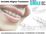Best Dental Clinic For Invisible Aligner Treatment 