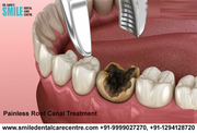 Who Needs Painless Root Canal Treatment?