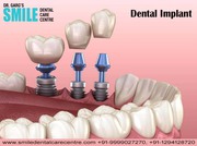 Best Dental Implant Clinics in Faridabad / Delhi NCR
