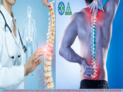 How to Know When Required Spine Surgery & Types of Spine Surgery 