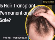 Best Hair Transplant Surgeon in Delhi and Gurgaon Offer Surgical Proce