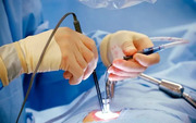 Top Hernia Surgery in Indirapuram In India 